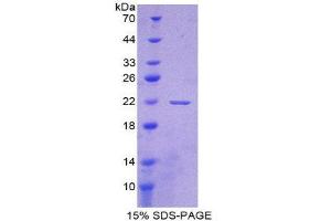 SDS-PAGE (SDS) image for Apolipoprotein A-I Binding Protein (APOA1BP) (AA 118-282) protein (His tag) (ABIN2124034)