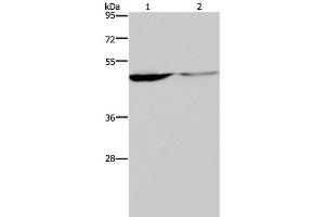 Western Blot analysis of Human paraneoplastic and normal kidney tissue using KCNK9 Polyclonal Antibody at dilution of 1:650 (KCNK9 antibody)