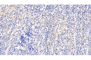 Detection of DTYMK in Mouse Kidney Tissue using Monoclonal Antibody to Deoxythymidylate Kinase (DTYMK) (DTYMK antibody  (AA 43-190))