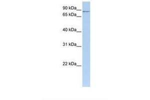 Image no. 1 for anti-MTO1 (AA 182-231) antibody (ABIN6739486) (MTO1 antibody  (AA 182-231))