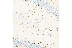 Immunohistochemistry of paraffin embedded mouse brain using SOX1 (ABIN7075712) at dilution of 1:2000 (300x lens) (SOX1 antibody)