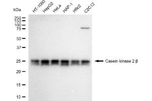 Western blotting analysis using Casein kinase 2 beta antibody (ABIN7797883). (Recombinant CSNK2B antibody)