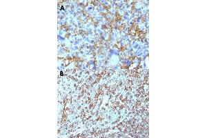 Immunohistochemical staining (Formalin-fixed paraffin-embedded sections) of human histiocytoma (A) and human tonsil (B) with HLA-DRB1 monoclonal antibody, clone LN-3 . (HLA-DRB1 antibody)