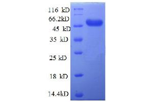 SDS-PAGE (SDS) image for AFG3-Like Protein 2 (AFG3L2) (AA 550-759), (partial) protein (GST tag) (ABIN5712331)