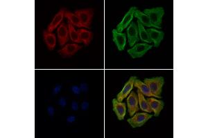 ABIN6265013 and ABIN6279108 staining Hela cells by IF/ICC. (alpha 2 Antiplasmin antibody  (C-Term))