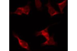 ABIN6267441 staining NIH-3T3 by IF/ICC. (RPS6KB1 antibody  (pSer424))