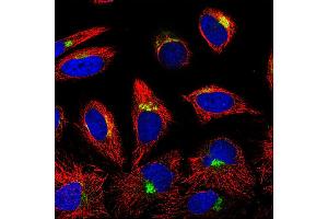 Image no. 1 for anti-Insulin-Like Growth Factor Binding Protein 7 (IGFBP7) antibody (ABIN181542) (IGFBP7 antibody)