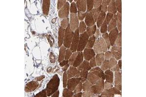 Immunohistochemical staining of human skeletal muscle with PFKM polyclonal antibody  shows strong cytoplasmic positivity in myocytes at 1:20-1:50 dilution.