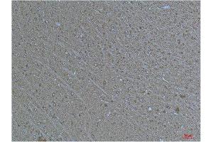 Immunohistochemistry (IHC) analysis of paraffin-embedded Human Brain Tissue using a-tubulin(Acetyl Lys40) Mouse Monoclonal Antibody diluted at 1:200. (alpha Tubulin antibody  (acLys40))