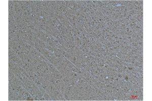 Immunohistochemistry (IHC) analysis of paraffin-embedded Human Brain Tissue using a-tubulin(Acetyl Lys40) Mouse Monoclonal Antibody diluted at 1:200. (alpha Tubulin antibody  (acLys40))