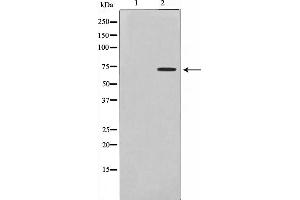 Western blot analysis on Jurkat cell lysate using DMPK Antibody,The lane on the left is treated with the antigen-specific peptide. (DMPK antibody  (N-Term))