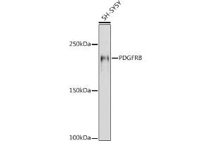 Western blot analysis of extracts of SH-SY5Y cells, using PDGFRB antibody (ABIN6134579, ABIN6145372 and ABIN7101437) at 1:1000 dilution. (PDGFRB antibody)