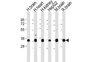 All lanes : Anti-KCNMB2 Antibody (N-term) at 1:2000 dilution Lane 1: human brain lysates Lane 2: human heart lysates Lane 3: human kidney lysates Lane 4: HepG2 whole cell lysates Lane 5: mouse brain lysates Lane 6: rat brain lysates Lysates/proteins at 20 μg per lane. (KCNMB2 antibody  (N-Term))