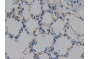 Detection of ICAM2 in Rat Lung Tissue using Polyclonal Antibody to Intercellular Adhesion Molecule 2 (ICAM2)