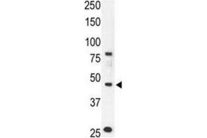Western Blotting (WB) image for anti-Chemokine Binding Protein 2 (CCBP2) antibody (ABIN3001323) (CCBP2 antibody)