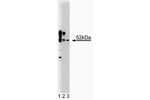 Western blot analysis of CaM Kinase II on a rat cerebrum lysate (First Panel). (CAMK2A antibody  (AA 448-460))