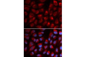 Immunofluorescence (IF) image for anti-Erythrocyte Membrane Protein Band 4.1 (Elliptocytosis 1, RH-Linked) (EPB41) antibody (ABIN1872554)