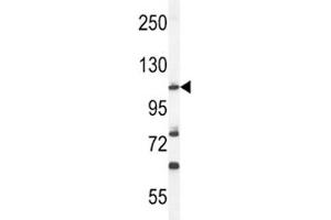 Western Blotting (WB) image for anti-Hypoxia Inducible Factor 1, alpha Subunit (Basic Helix-Loop-Helix Transcription Factor) (HIF1A) (AA 519-547) antibody (ABIN3031284)