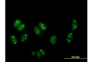 Immunofluorescence of purified MaxPab antibody to DDX54 on HeLa cell. (DDX54 antibody  (AA 1-881))