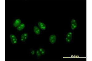 Immunofluorescence of purified MaxPab antibody to DDX54 on HeLa cell.