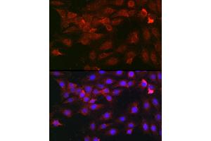 Immunofluorescence analysis of C6 cells using Heparanase 1 Rabbit pAb (ABIN6128033, ABIN6141977, ABIN6141978 and ABIN6221391) at dilution of 1:100 (40x lens). (HPSE antibody  (AA 36-275))