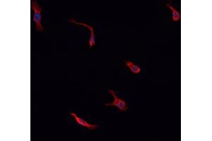 ABIN6276765 staining HepG2? (IDO1 antibody  (Internal Region))