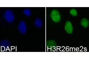 Immunofluorescence analysis of 293T cell using H3R26me2s antibody. (Histone 3 antibody  (H3R26me2s))