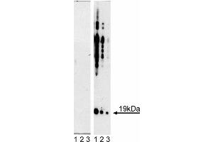 Western blot analysis of alpha-Synuclein (pY125). (SNCA antibody  (pTyr125, Tyr125))