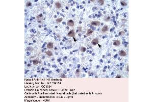 Human Brain (RNF141 antibody  (Middle Region))