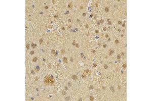 Immunohistochemistry of paraffin-embedded mouse brain using DNMT3A antibody at dilution of 1:200 (x400 lens) (DNMT3A antibody)