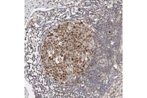 Immunohistochemical staining of human appendix with CDCA7L polyclonal antibody  shows strong nuclear positivity in lymphoid reaction center cells at 1:500-1:1000 dilution.