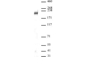 DOT1L antibody (pAb) tested by Western blot. (DOT1L antibody  (C-Term))