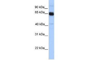 WB Suggested Anti-PRKAA1 Antibody Titration: 0. (PRKAA1 antibody  (N-Term))
