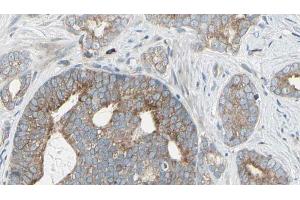 ABIN6268974 at 1/100 staining Human prostate tissue by IHC-P. (EIF4B antibody  (pSer422))