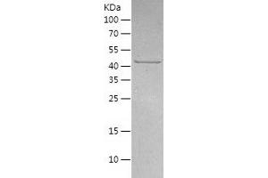Western Blotting (WB) image for Casein Kinase 1, gamma 2 (CSNK1G2) (AA 18-415) protein (His tag) (ABIN7122157) (Casein Kinase 1 gamma 2 Protein (AA 18-415) (His tag))