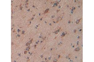Used in DAB staining on fromalin fixed paraffin- embedded Kidney tissue (SLC44A1 antibody  (AA 74-183))