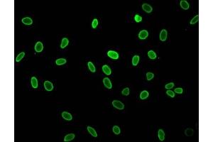 Immunofluorescent analysis of Hela cells (sodium butyrate, 30 mM, 4h) using ABIN7139162 at dilution of 1:100 and Alexa Fluor 488-congugated AffiniPure Goat Anti-Rabbit IgG(H+L) (HIST1H1C antibody  (acLys16))