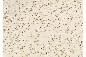 ABIN6265493 and ABIN6279878 at 1/100 staining Rat brain tissue by IHC-P. (TCEAL2 antibody  (Internal Region))