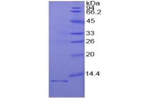 SDS-PAGE of Protein Standard from the Kit  (Highly purified E. (IL1R1 ELISA Kit)