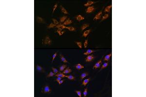 Immunofluorescence analysis of C6 cells using FGF2 Rabbit pAb (ABIN3020744, ABIN3020745, ABIN3020746 and ABIN6213702) at dilution of 1:100 (40x lens). (FGF2 antibody  (AA 143-288))