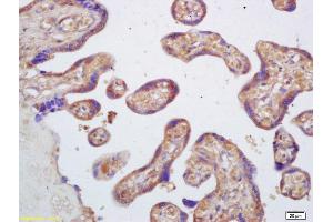 Formalin-fixed and paraffin embedded human placenta labeled with Rabbit Anti PAFAH2/Lp-PLA2 Polyclonal Antibody, Unconjugated (ABIN686722) at 1:200 followed by conjugation to the secondary antibody and DAB staining (PLA2G7 antibody  (AA 301-441))