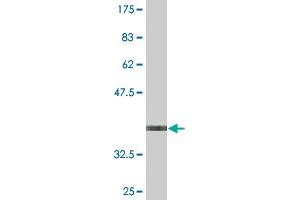 Western Blot detection against Immunogen (35. (STK40 antibody  (AA 349-434))