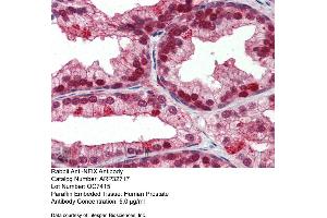 Immunohistochemistry with Human Prostate lysate tissue at an antibody concentration of 5. (NFIX antibody  (Middle Region))