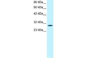 WB Suggested Anti-JMJD8 Antibody Titration:  0.