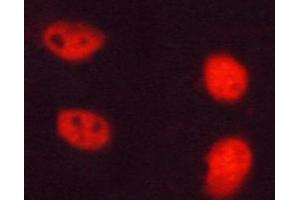 Immunofluorescence (fixed cells) (IF/ICC) image for anti-Nucleophosmin (Nucleolar phosphoprotein B23, Numatrin) (NPM1) (pThr199) antibody (ABIN6256499)