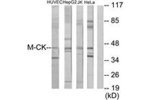 Western blot analysis of extracts from Jurkat/HeLa/HepG2/HuvEc cells, using M-CK Antibody. (CKM antibody  (AA 10-59))