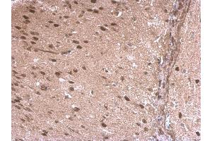 IHC-P Image LDB1 antibody [N2C3] detects LDB1 protein at nucleus on rat middle brain by immunohistochemical analysis.