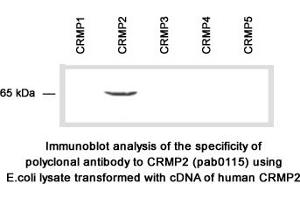 Image no. 2 for anti-Collapsing-Response Mediator Protein 2 (CRMP-2) (C-Term) antibody (ABIN347037)
