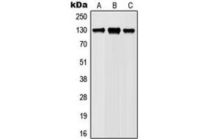 Western blot analysis of JAK1 (pY1022) expression in Ramos (A), Jurkat (B), L929 (C), PC12 (D) whole cell lysates.
