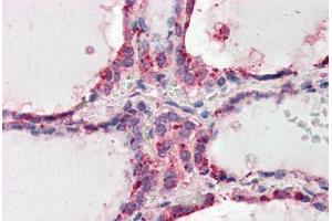 Human Thyroid (formalin-fixed, paraffin-embedded) stained with WNT3 antibody ABIN461935 at 3.